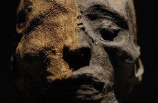 Study of mummies reveals heart disease may have been common in ancient world